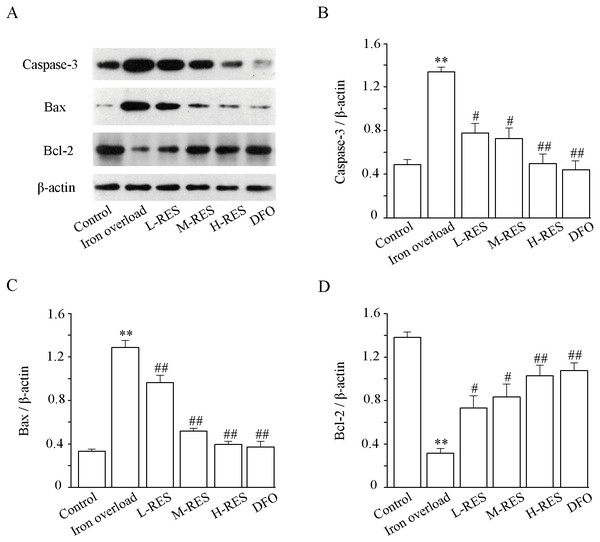 Effects of RES on caspase-3 (B), Bax (C) and Bcl-2 (D) in liver of iron-overload mice.