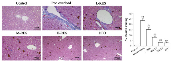Effects of RES on the degree of liver fibrosis were observed by Masson staining.