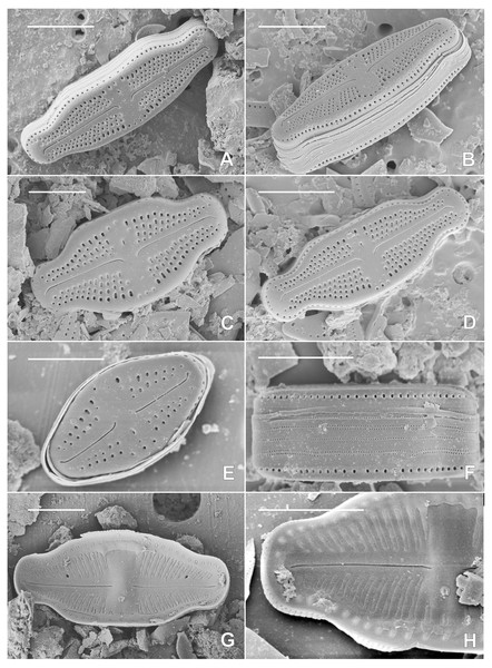 SEM pictures of the holotype population of Luticola kaweckae.