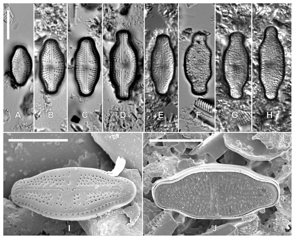 LM (A–H) and SEM (I–J) pictures of teratological forms of Luticola kaweckae.