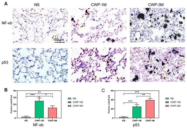 Coal dust exposure upregulates NF-κB and p53 expression in lung tissue.
