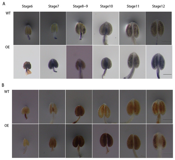 Comparison of ROS level between wild-type and overexpressing expression Arabidopsis anthers.