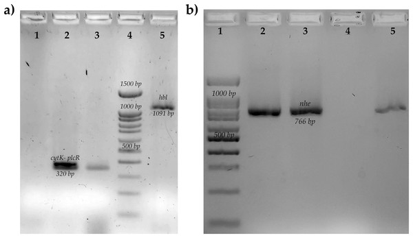 Molecular identification of toxins genes of B. cereus from coriander isolation.