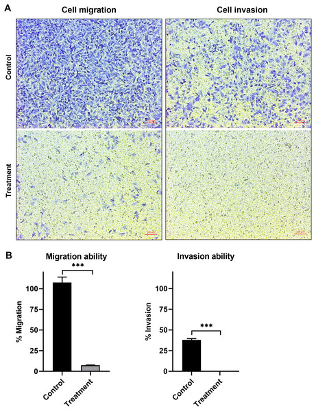 Natural peptides from T. stans markedly inhibited cell migration and invasion.