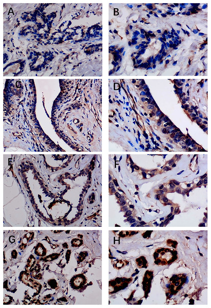 Immunohistochemistry staining of EZH1 in normal breast tissue samples.
