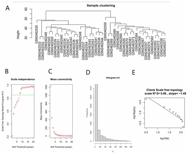 Data verification and filter the best soft threshold.