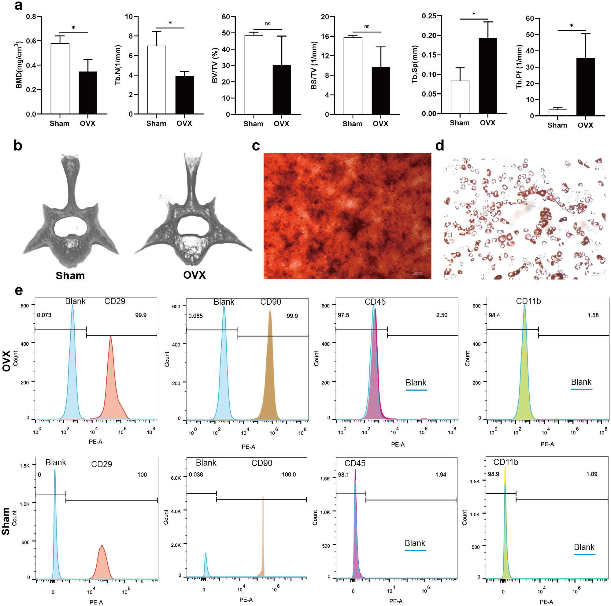 BMSC-derived exosomal miR-27a-3p and miR-196b-5p regulate bone