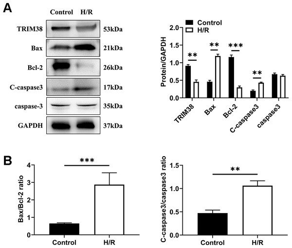 TRIM38 expression and its roles in H9c2 cells exposed to H/R. H9c2 cells were exposed to 6 h of hypoxia, followed by 6 h of reoxygenation.