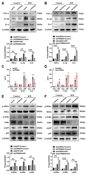 TRIM38 ameliorates inflammation in H/R-treated H9c2 cells via the NF-κ B pathways.