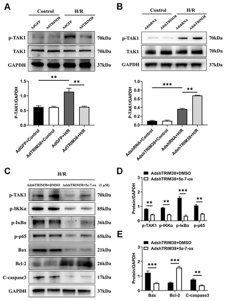 TRIM38 inhibited TAK1-NF-κB signaling axis in H9c2 cells.