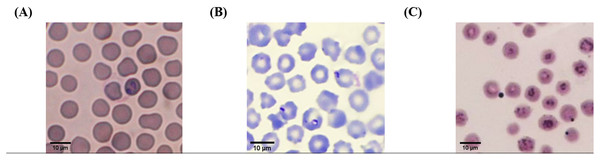 Typical morphology of cattle hemoparasitic infection in a thin blood smear stained with 10% Giemsa showing multiple infected RBCs.
