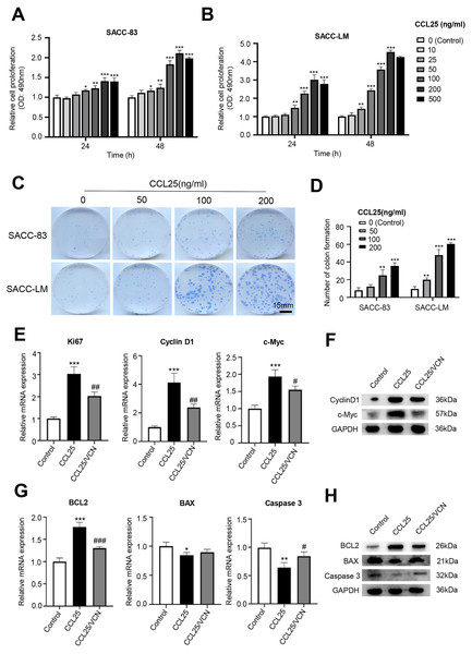 CCL25/CCR9 promotes the proliferation of SACC cells.
