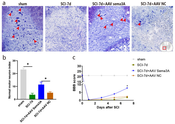 Inhibition of Sema3A/NRP1 signaling promotes neural function recovery after SCI.