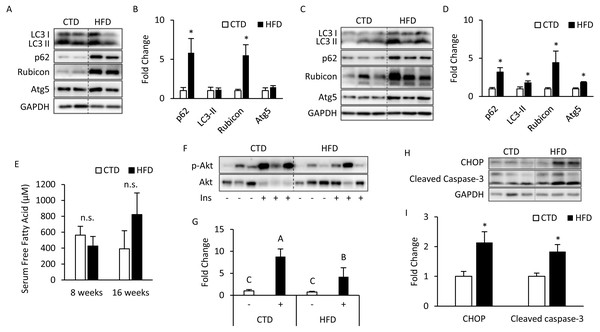 Altered autophagy, insulin resistance, and ER stress in adipose tissues from mice fed with 8- and 16-week HFD.
