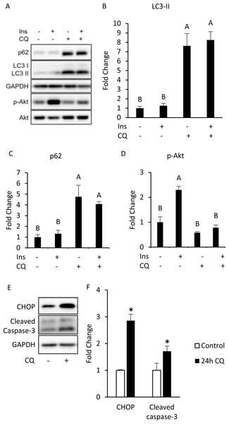 Autophagy inhibition, insulin resistance, ER stress and apoptosis were found in 3T3-L1 after CQ treatment for 24 h.