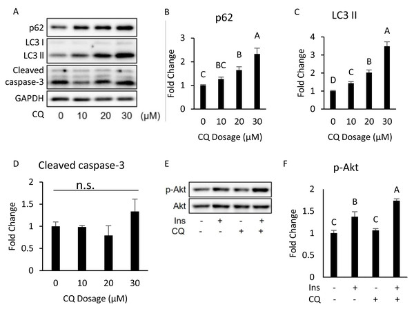 Dose–response experiment of CQ treatment in 3T3-L1 cells and insulin resistance, ER stress, and apoptosis were observed in 3T3-L1 after 20 µM CQ treatment for 48 h.
