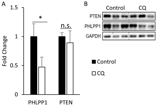 Autophagy may regulate insulin-stimulated signal transduction without associated with PHLPP1 and PTEN.