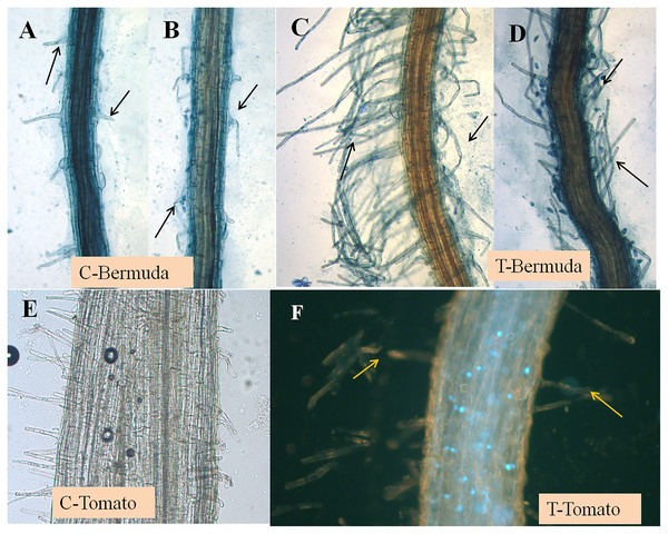 (A–F) Effect of inoculation of E. coli on root hair formation in Bermuda grass and tomato seedlings.