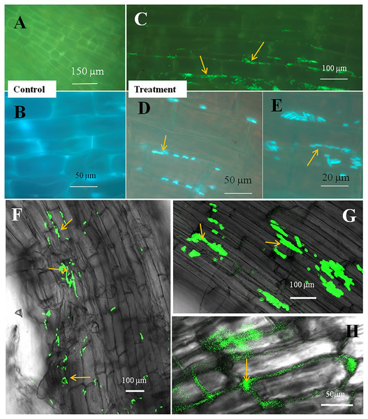 Microscopic observation of tomato root tissue inoculated with GFP tag E. coli.