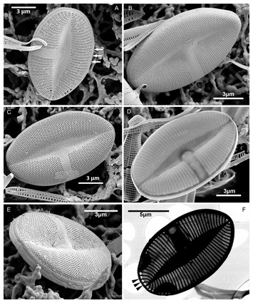 Xenobennettella coralliensis a new monoraphid diatom genus characterized by  the alveolate sternum valve with cavum, observed from coral reef habitats  [PeerJ]