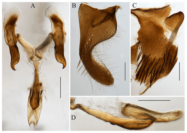 Male genitalia of Atkinsoniella zizhongi sp. nov.