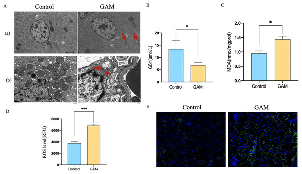 Rats injected with GAM could induce autophagy-dependent ferroptosis in renal tissues.