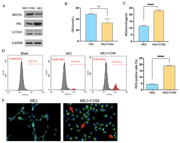 CaOx could induce autophagy-dependent ferroptosis in HK2 cells.