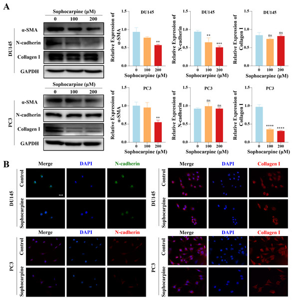 Sophocarpine inhibited EMT progression in CRPC cells.