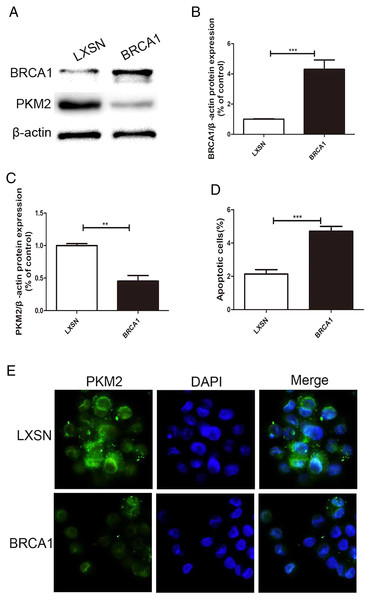 BRCA1 overexpression decreased the expression of PKM2 and increased apoptosis in MCF-7 cell.