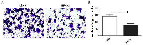 BRCA1 overexpression attenuated the migration of MCF-7 cells.
