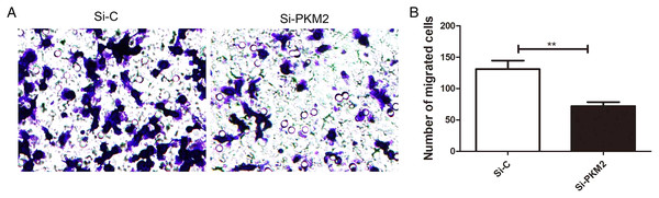 Inhibiting PKM2 attenuated the migration of MCF-7 cells.