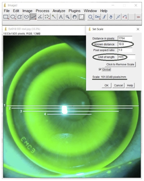 ImageJ screenshot of measurement procedure conducted by each observer.
