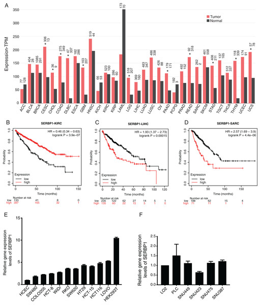 SERBP1 expression was dysregulated in multiple cancer types and affected overall survival time of patients with cancers.