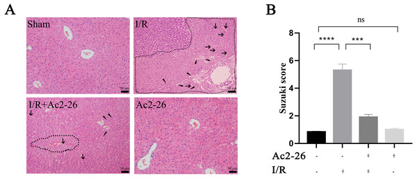 Ac2-26 improved HIRI -induced liver injury.