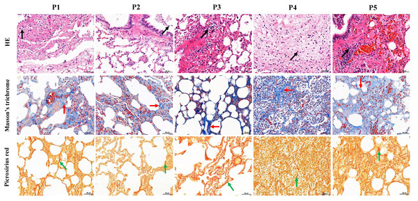 Histological analysis of five dead forest musk deer lung tissue (400×).