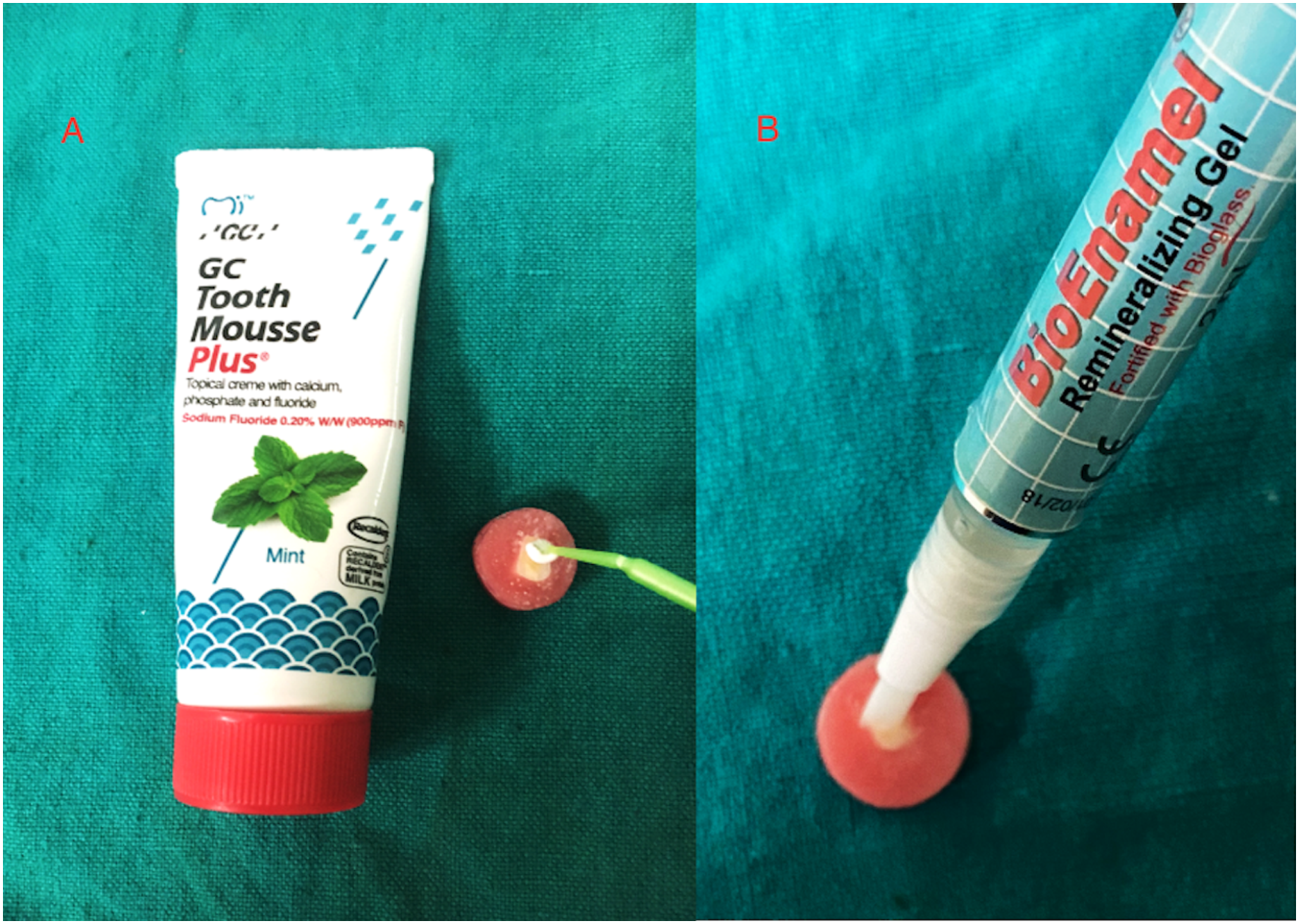 Tooth mousse launched  British Dental Journal