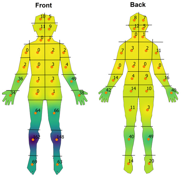 Overall heat-map visualisation of the distribution of impetigo on front and back human-body shapefiles.