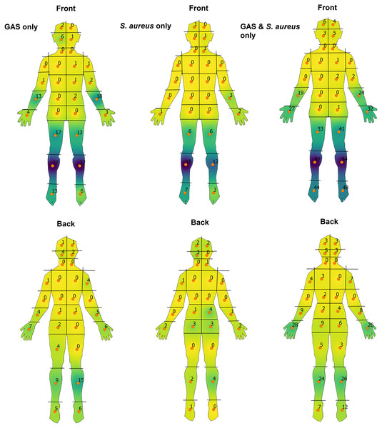 Heat-map visualisation of the body-distribution of impetigo stratified by causative pathogen.