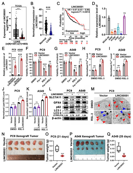 LINC00551 expression in LUAD and its effect on RSL-3-induced ferroptosis and autophagy in LUAD cells.