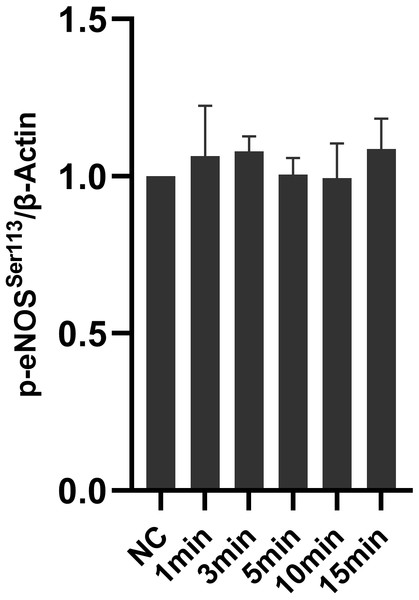 Effect of Icariside II on the expression of p-eNOSSer113.