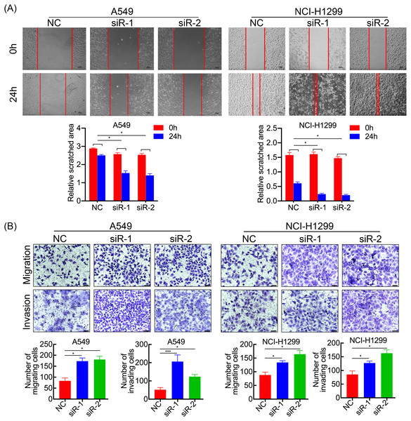 SPC21 tumor-suppressing ability on invasion and migration in LUAD cells.