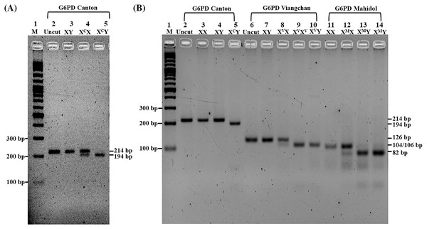 Characterization of G6PD mutations by PCR-RFLP.
