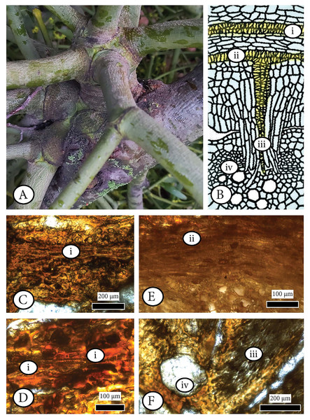 Examining the infestation of a mistletoe (Viscum album) in a host (Pyrus malus) as a possible analogue of the observed anatomical patterns in Cupressinoxylon matromnense Grambast from Gökçeada, Turkey.