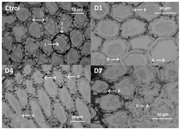 Micrograph of the hepatopancreas of shrimp fed with feed-AgNPs and control without AgNPs.