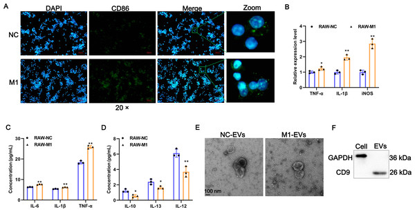 Identification of EV-derived from M1 macrophages.