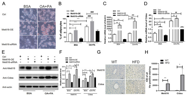 METTL16-mediated m6A methylation promoted the NAFLD progression through upregulating the expression levels of CIDEA.