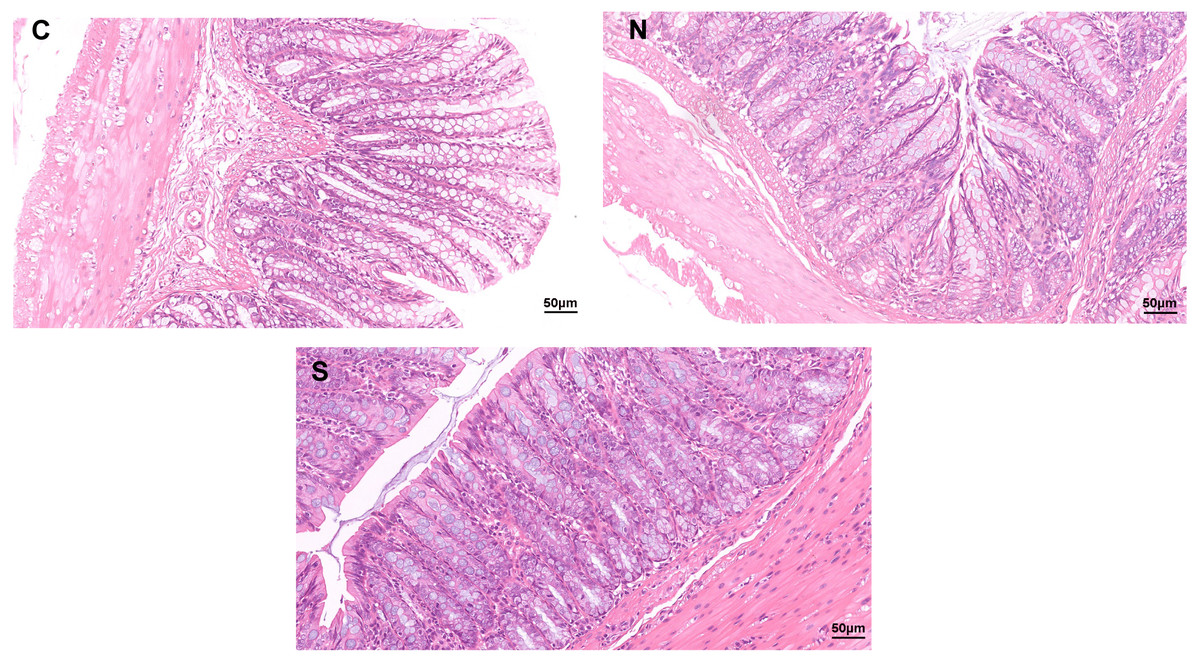 The effects of Saccharomyces boulardii on rat colonic hypermotility ...