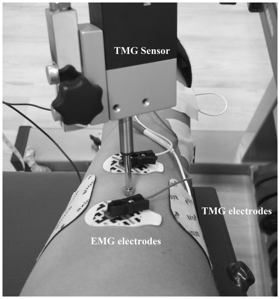 Location of the TMG and EMG electrodes as well as the TMG sensor.