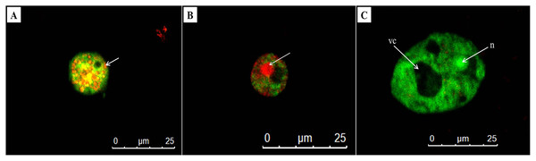 Representative images of Acanthamoeba triangularis trophozoites stained with AO/PI dye under fluorescent microscopy.