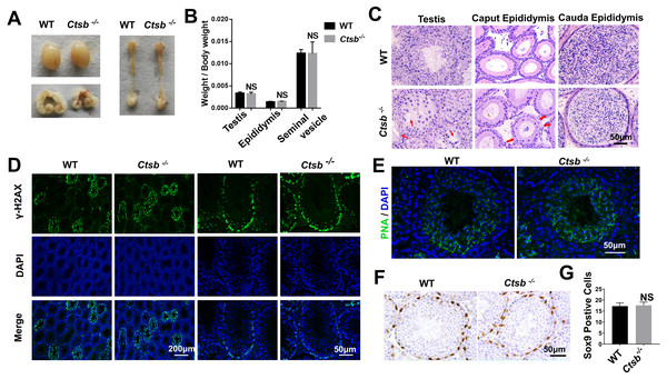 Spermatogenesis of Ctsb-/- mice.